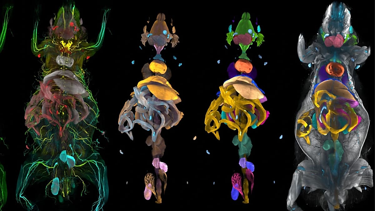 AI-Powered Body Atlas Reveals Obesity's Systemic Damage, Including Nerve Loss