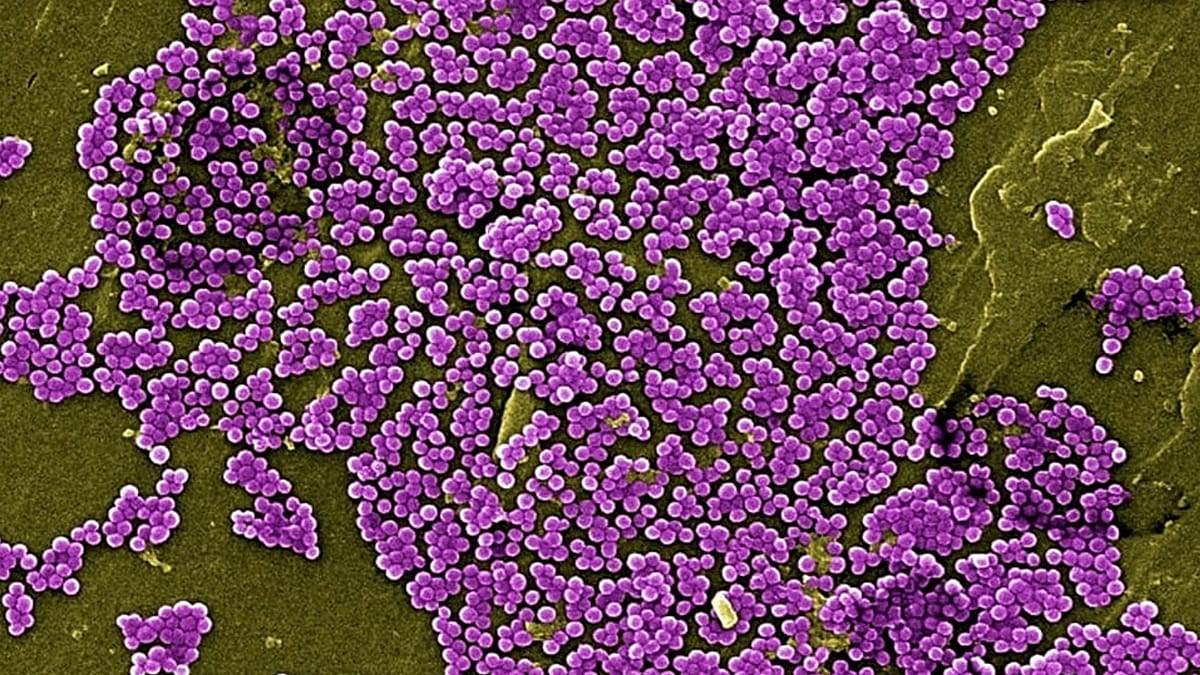 Barcelona-Led Team Finds Way to Break Up Antibiotic-Resistant Biofilms