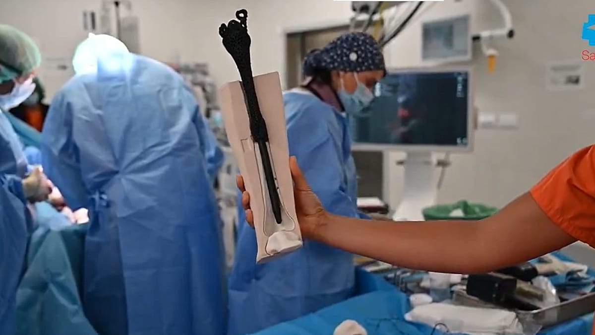 Madrid hospital pioneers 3D-printed bone implant to save leg from amputation