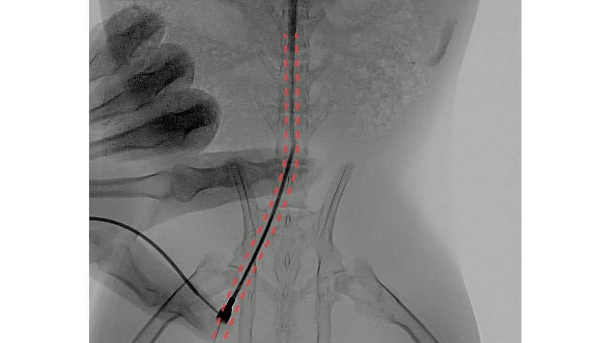 Magnetic micro-robot could refine drug delivery and cancer detection