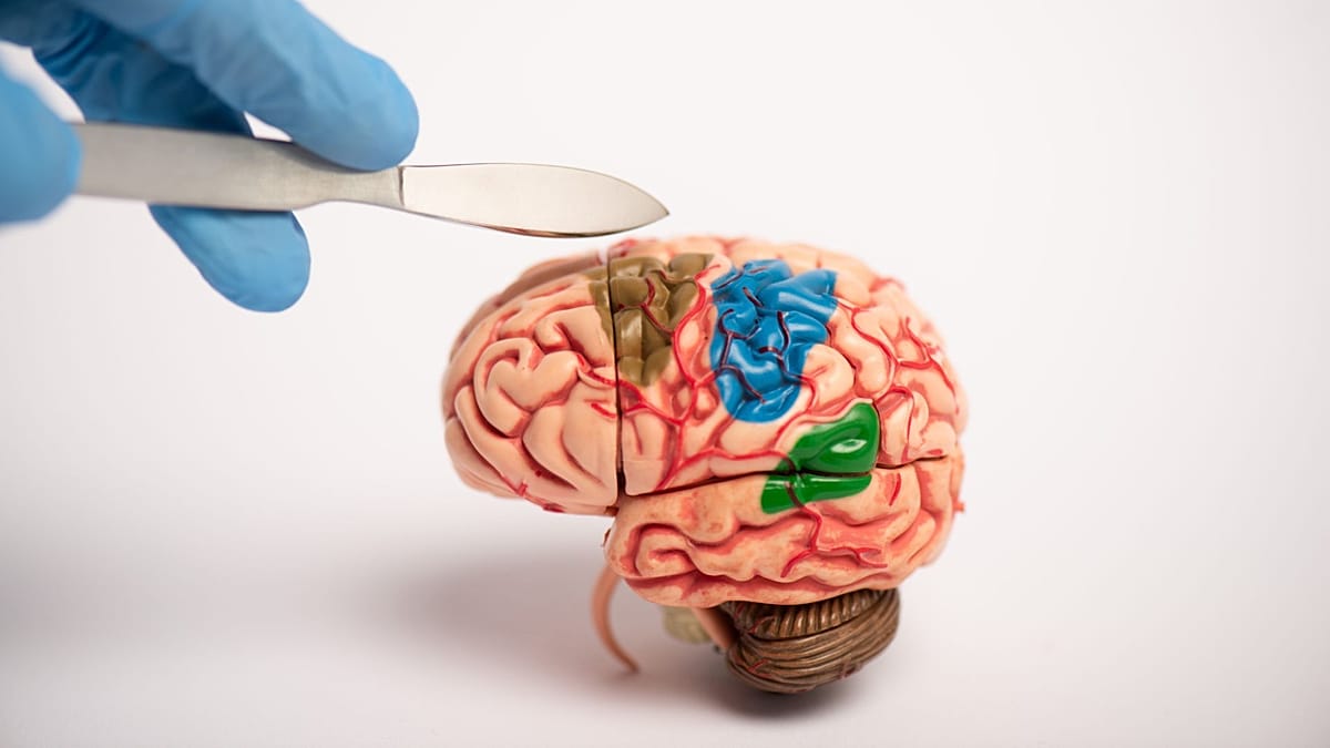 Young brains' adaptability may fuel post-injury epilepsy, study finds